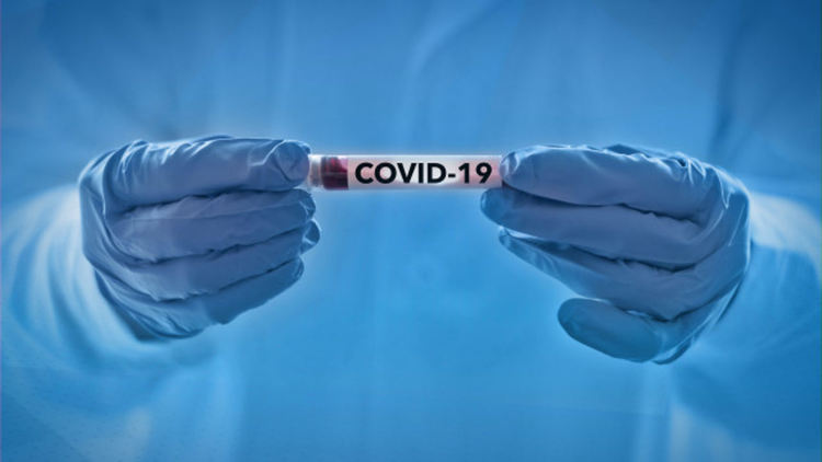 Първа положителна проба за COVID-19 във Варна