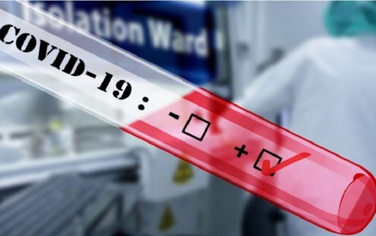 Срив на болните от ковид-19, в страната -26 за 31 август, 5 са в Смолянско