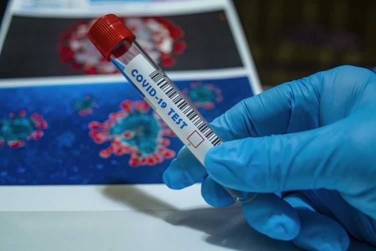 6 починали и 118 заразени, сред които четирима лекари и 24 души от Дома в Пъстрогор
