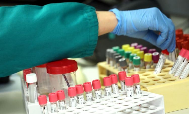 3 заразени и един починал с коронавирус в Хасковско, 137 са в болници