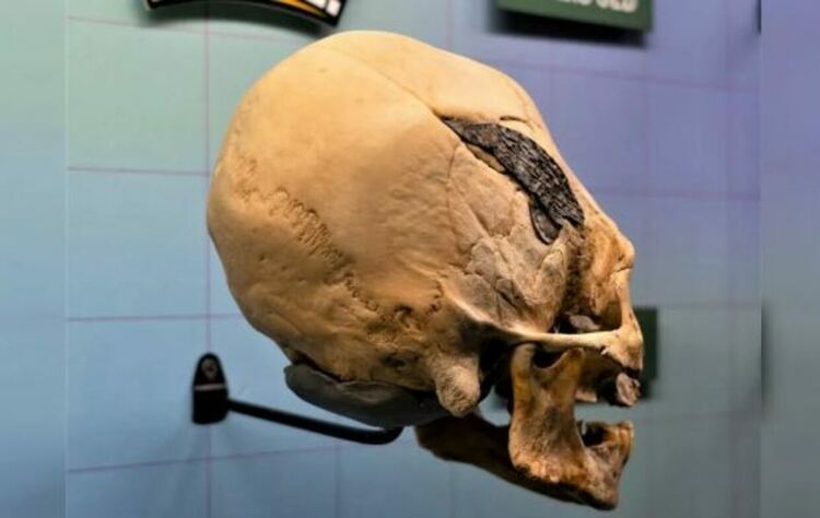 Древен хирургически имплант или съвременна фалшификация? Черепът от Перу остава загадка