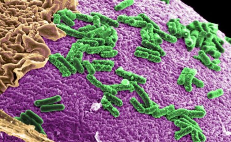 Asaccharobacter celatus - бактерията, която оздравява мозъка