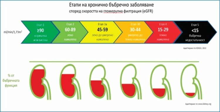 На 14 и 15 юни правят безплатни изследвания за бъбречното здраве в Маджарово и Ивайловград